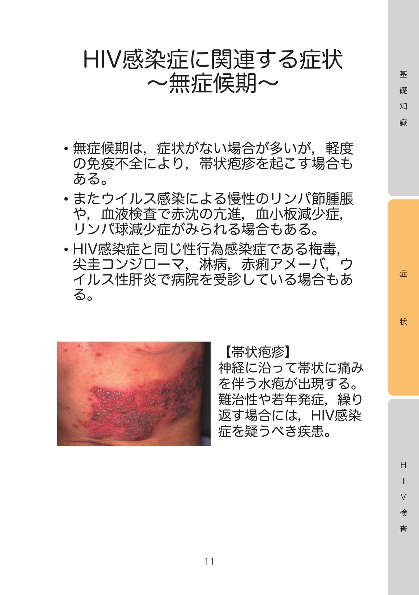 HIV感染症に関連する症状〜無症候期〜