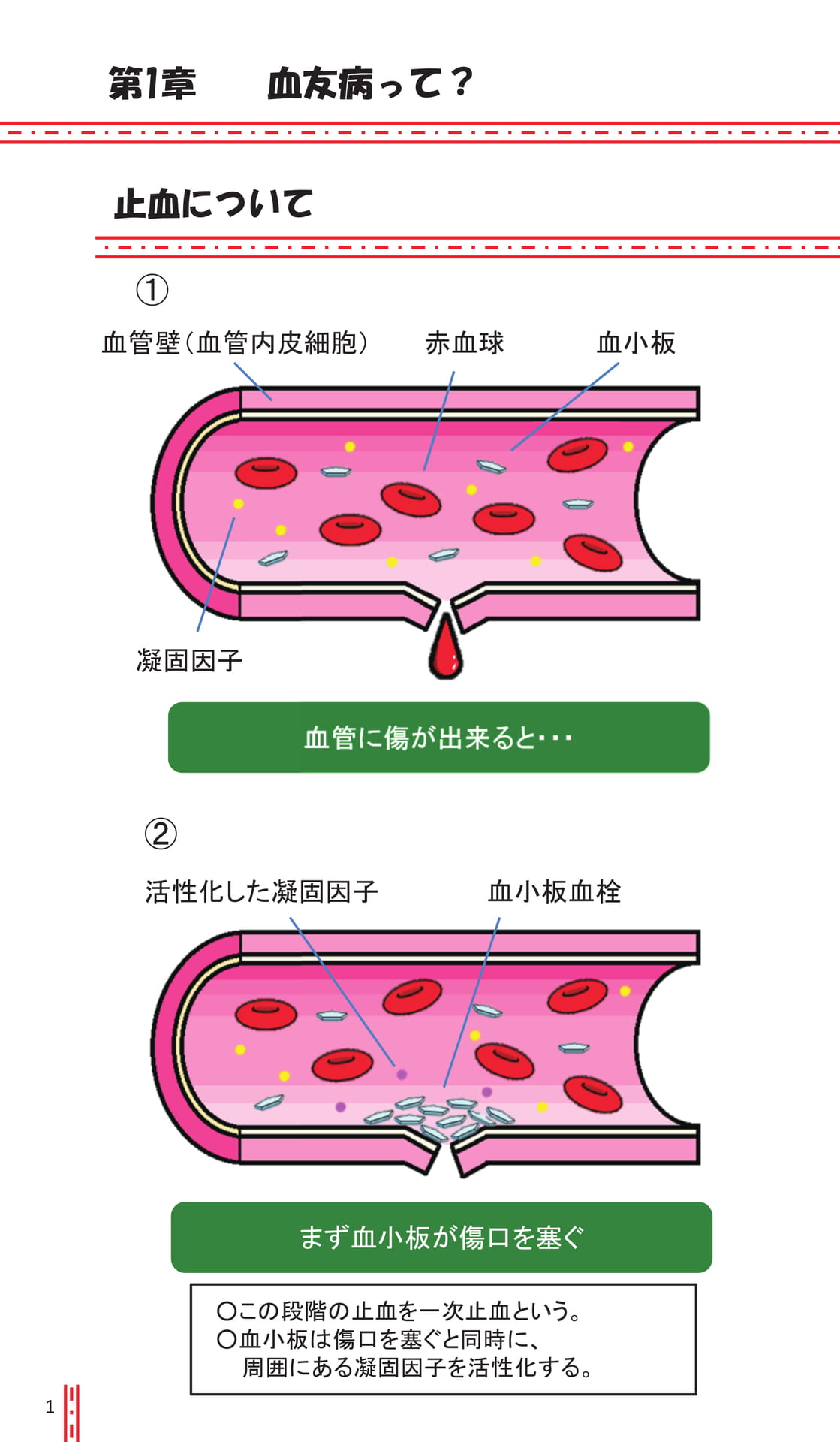 第1章 血友病って?