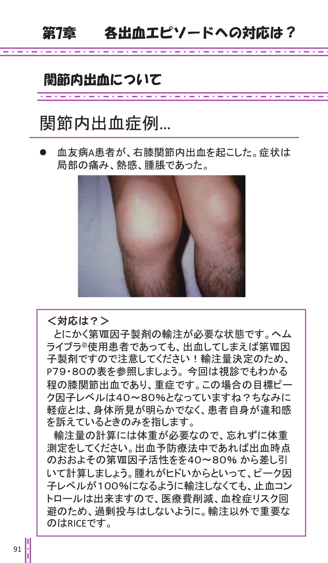 第7章 各出血エピソードへの対応は?