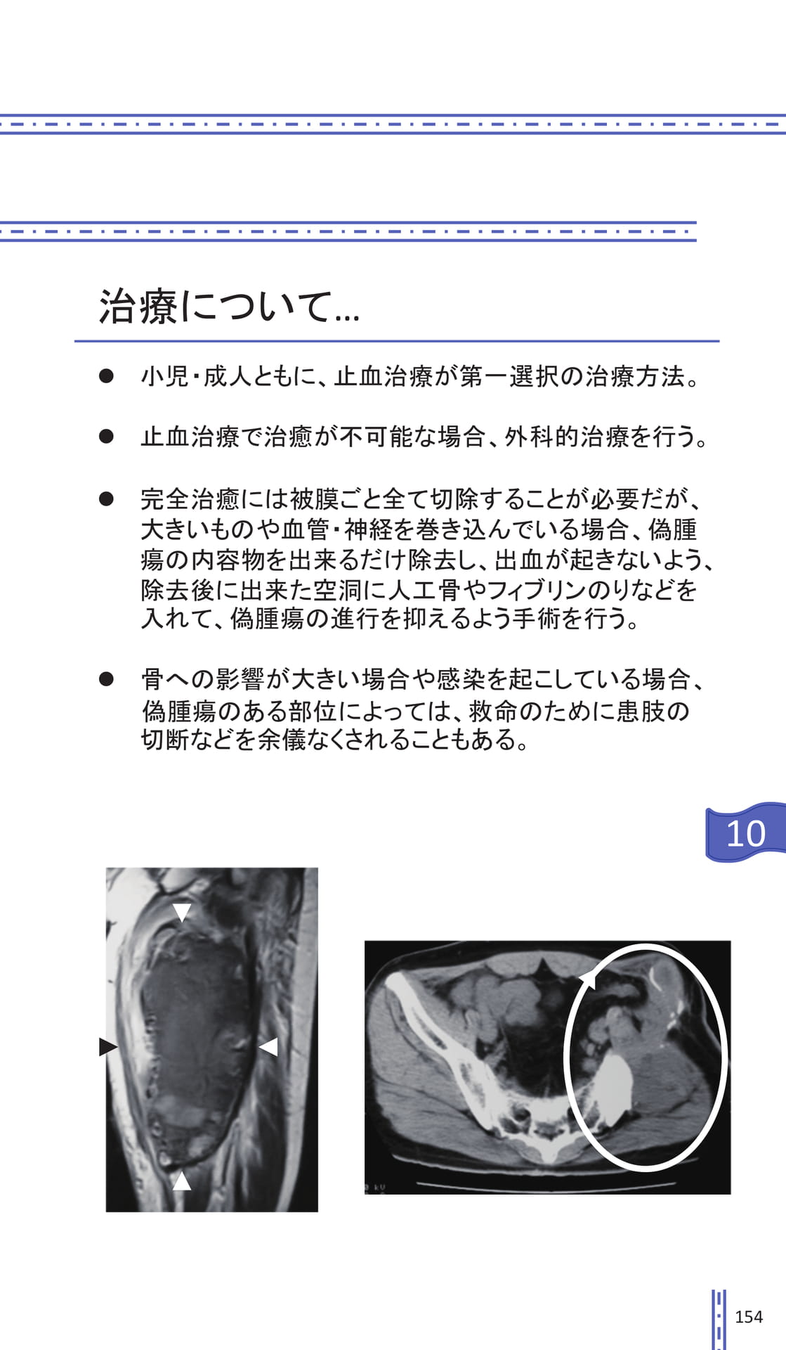 Page 154